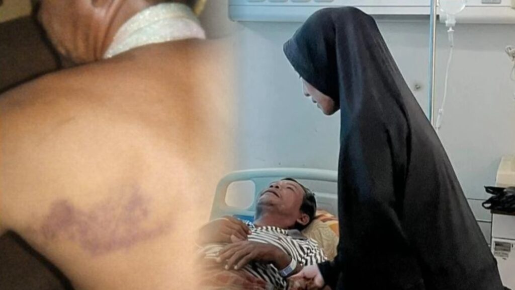 Oknum Polisi Diduga Aniaya Warga di Takalar, Korban Sempat Dirawat di RS