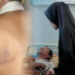 Oknum Polisi Diduga Aniaya Warga di Takalar, Korban Sempat Dirawat di RS