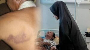 Oknum Polisi Diduga Aniaya Warga di Takalar, Korban Sempat Dirawat di RS